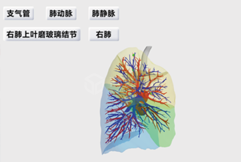 3D心脏模型虚拟手术辅助三维演示