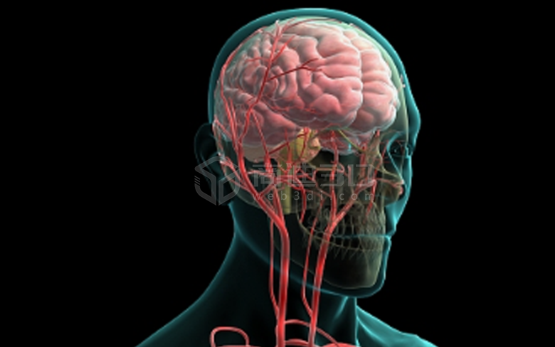 医学脑梗手术过程三维动画视频模拟演示