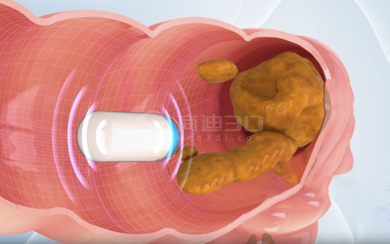 膠囊機器人醫學醫療三維動畫視頻消化道震動演示制作