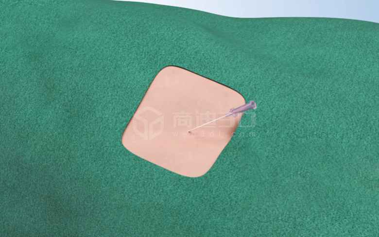 醫療穿刺三維動畫視頻制作